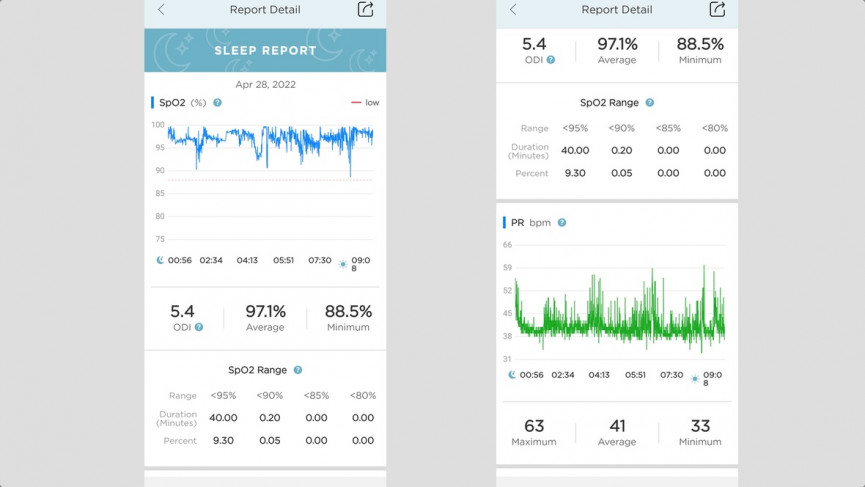 Prevention Circul+ smart ring review